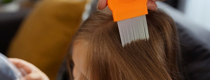 What Are Different Head Lice Screening Options?